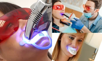 Diş Beyazlatma Yöntemleri: Evde ve Profesyonel Uygulamalar