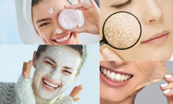 Kış Aylarında Cilt Kuruluğunu Önlemek İçin İpuçları